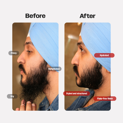 Beard Fixer Duo